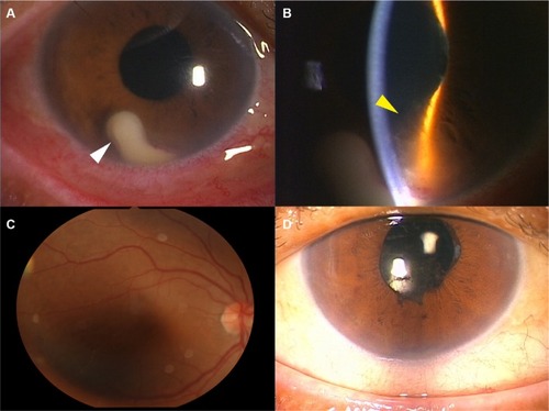 Figure 1 Photographs of the right eye on days 1 and 17.