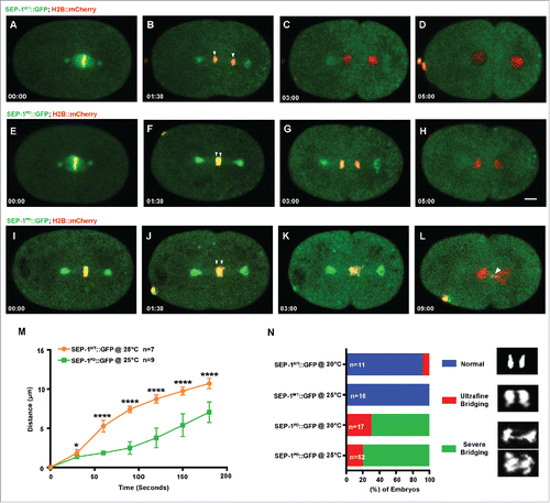 Figure 1. SEP-1PD::GFP causes chromosome segregation defects during mitosis. Representative images of mitotic chromosome segregation in SEP-1WT::GFP expressing embryos (A-D, green) or homozygous SEP-1PD::GFP (green) embryos with slight bridging (E-H) and severe bridging (I-L) co-expressing H2B::mCherry (red). (M) Average distance between separating sister chromatids (as shown by arrowheads in B, F, J) during anaphase in SEP-1WT::GFP (n = 7) or SEP-1PD::GFP (n = 9) embryos from metaphase to late cytokinesis. (N) Percentage of embryos displaying normal chromosome separation (blue), slight bridging chromosomes (red) or severe chromosome bridges (green) during the first mitosis in embryos expressing either SEP-1WT::GFP or SEP-1PD::GFP at the temperature indicated (n = number of embryos imaged). Insert shows H2B::mCherry images scored as normal, slight bridging and severe bridging. Scale Bars, 10 μm. P-values: * = <0.05; **** = <0.0001 (t-test). Error bars indicated standard deviation of the mean.