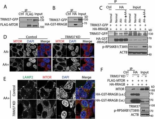 Figure 3. TRIM37 interacts with MTOR and RRAGB proteins and its depletion inhibits MTOR-RRAGB interaction and lysosomal distribution of MTOR. (a) HEK 293T cells were transfected with FLAG-MTOR and TRIM37-GFP constructs. After 24 h, equal amounts of cell lysates were collected for immunoprecipitation (IP) with control IgG (Ctrl) or FLAG antibody, followed by protein detection with GFP and MTOR antibodies. (b and c) HEK 293T cells were transfected with HA-GST-RRAGB and TRIM37-GFP constructs. After 24 h, cells lysates were collected (normal). Alternatively, cells were starved for amino acid for 2 h (AA-) and stimulated with amino acid-containing media for 1 h (AA+). Equal amounts of cell lysates were collected for immuno-precipitation (IP) with control IgG (Ctrl) or HA antibody. GFP and HA-HRP antibodies were used to detect TRIM37-GFP and HA-GST-RRAGB, respectively. (d and e) HepG2 control and TRIM37 KD cells were incubated in amino acid-depleted media [Citation38] for 2 h (AA-) and then stimulated with amino acid-containing media (AA+) for 15 min. Nuclei were stained with DAPI. (d) Cells were immuno-stained with MTOR antibody. (e) Cells stimulated with AA (15 min) were co-stained with MTOR and LAMP2 antibodies. The images were acquired by confocal microscopy. Scale bars: 10 μm. (F) HEK 293T control and TRIM37 KD cells were transfected with FLAG-MTOR and HA-GST-RRAGB constructs. After 24 h, equal amounts of cell lysates were collected for immuno-precipitation (IP) with control IgG (Ctrl) or HA antibody, followed by protein detection with the indicated antibodies. s.e. short exposure; l.e. long exposure