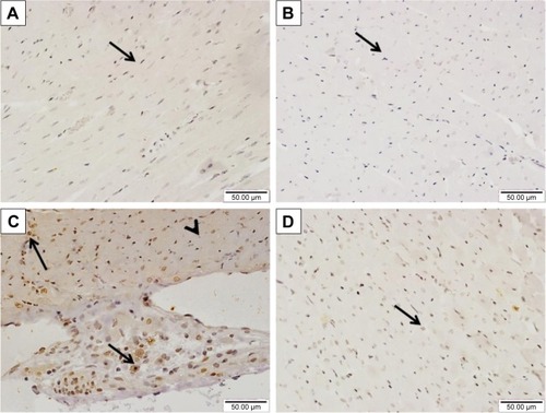 Figure 7 Effect of sitagliptin on JAK2 phosphorylation in the heart of control and diabetic rats.