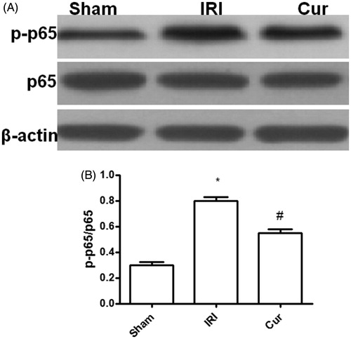 Figure 3. Effects of Curcumin pretreatment on the expression of p65 and p-p65 after renal ischemia-reperfusion injury. Western blot analysis was employed to the expression of p65 and p-p65. (A) A representative result for Western blot analysis p65. (B) Semi-quantitative analysis of 10 animals studied in each group. The relative amounts of p-p65 and p65 in each group of rats were normalized by β-actin and presented as a ratio between p-p65 and p65. *p < .05 (IRI vs. Sham); #p < .05 (Cur vs. IRI).