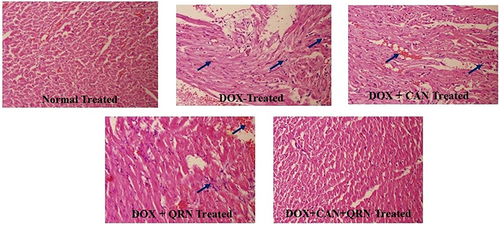 Figure 2 Effect of CAN, QRN, and CAN+ QRN on histopathology of cardiac tissue. (DOX – doxorubicin; QRN – quercetin; CAN – candesartan) Blue arrow depicts more amount of leukocyte infiltration and intramuscular hemorrhage in DOX treated group as compared to the treatment groups.