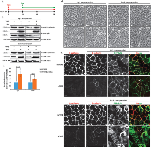 Figure 8. Lgl1 and Scrib re-expression impedes TGFβ-induced EMT. (a) schematic representation of time-line of cell treatment with TGFβ and Dox. A549 cells expressing Dox-inducible GFP-Lgl1 or Dox-inducible GFP-Scrib were stimulated with TGFβ for 24 hr followed by incubation with or without Dox for additional 48 hr. (b) cell lysates were analyzed by IB with antibodies against E-cadherin, Scrib or Lgl1 and actin. Molecular weights of the proteins are indicated. *GFP-Lgl1. (c) quantification of Scrib and Lgl1 protein levels with TGFβ, with or without Dox relative to control levels normalized to actin. Values are the mean ± SD from three independent experiments subjected to two-tailed, two-sample, and unequal-variance Student’s t test. (d) phase-contrast images of the cells were taken by fluorescence microscopy. Scale bar, 20 µm. (e) cells treated as in a were fixed and immunostained for E-cadherin. E-cadherin, GFP-Lgl1 and GFP-Scrib were visualized by confocal microscope. Scale bar, 10 µm. Arrows indicate co-localization of E-cadherin and GFP-Lgl1 or GFP-Scrib at AJs.