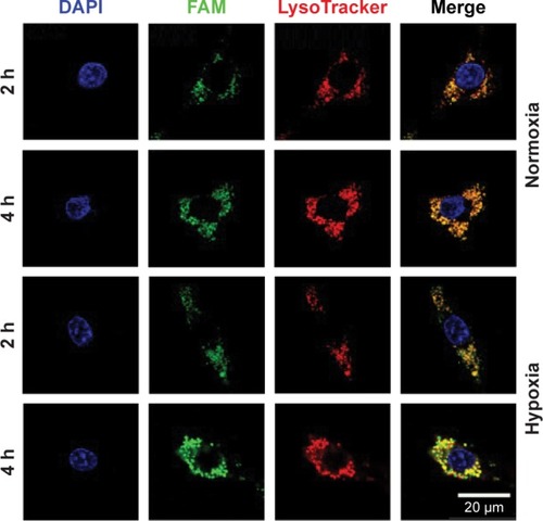 Figure 6 Confocal laser scan microscopy images of C6 cells with MLP/FAM-siRNA incubation under hypoxia and normoxia for 2 and 4 h.Notes: The nucleus was stained by Hoechst 33342, endosome was stained by LysoTraker Red, and FAM-siRNA was stained green (scale bar =20 μm).Abbreviations: siRNA, small interference RNA; DAPI, 4′,6-diamidino-2-phenylindole.