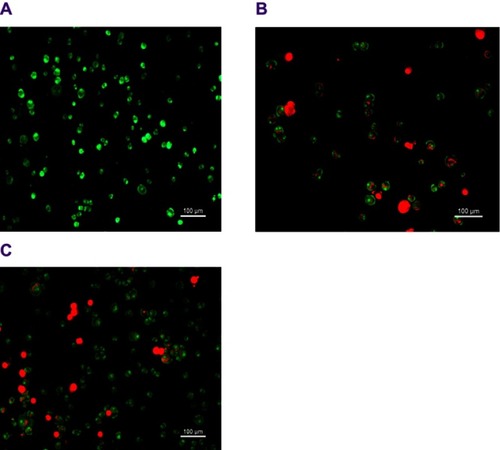 Figure 10 Fluorescent microscopy images of MCF-7 cells at 48 hrs stained by acridine orange and propidium iodide (AO/PI) (A) control MCF-7 cells (untreated), (B) treated with DOX, and (C) treated with doxorubicin nanoparticles (DOX-NPs). Scale bar: 100 µm.