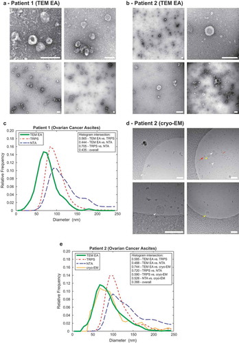 Figure 4. Comparison of the TEM ExosomeAnalyzer with other methods.Representative TEM images used are shown in (a) for Patient 1 and in (b) for Patient 2, both samples are ovarian cancer ascites. The white bar represents 200 nm in each image. (c) Comparison of size distribution profiles of exs measured by TEM ExosomeAnalyzer (TEM EA), TRPS and NTA in the range applicable for all methods depicts coherent results for all approaches. Representative cryo-EM images used are shown in (d) for Patient 2, arrowheads indicate EVs. EVs containing the characteristic phospholipid bilayer (white arrowheads) as well as multi-layered vesicles (yellow arrowheads) and electron dense particles, which are likely lipoprotein particles (red arrows), were observed. (e) Comparison of size distribution profiles of EVs from Patient 2 measured by TEM ExosomeAnalyzer (TEM EA), TRPS, NTA and cryo-EM (data were acquired using TEM EA, each EV was manually outlined) in the range applicable for all methods depicts coherent results for all approaches. TEM EA provides comparable results to those of TRPS and NTA. Moreover, TEM EA and cryo-EM are able to analyse also vesicles smaller than the detection limit of TRPS and NTA. Interestingly, it seems that EVs do not shrink during processing for TEM as evidenced by largely overlapping histograms between TEM EA and cryo-EM.