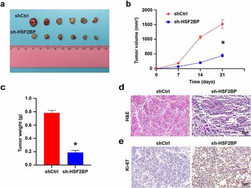 Figure 5. HSF2BP promotes the tumor growth in vivo. (a) The tumor formed by shCtrl and sh-HSF2BP cells. (b) Tumor volume. (c) Tumor weight. (d) HE staining. (e) Ki67 expression detected by immunohistochemistry. Note: * p < 0.001.