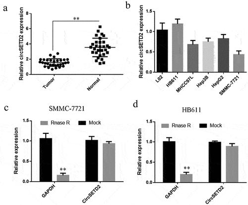 Figure 1. circSETD2 is lowly expressed in liver cancer tissues and cell lines. (a) qRT-PCR was used to detect the expression of circSETD2 in 30 liver cancer tissues and corresponding paracancerous tissues. (b) qRT-PCR was used to detect the expression of circSETD2 in normal liver cells and liver cancer cell lines. (c, d) GAPDH was used as a mock for circSETD2 expression following treatment with 1 mg/mL of RNase-A. **p < 0.01, *p < 0.05.