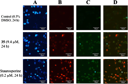 Fig. 7. Introduction of apoptosis by caspase 3/7. (A) Chromatin condensation pattern (blue) in HeLa cells stained with Hoechst. (B) Dead cells (red) detected with propidium iodide (PI) staining. (C) Active caspase 3/7 (green). (D) Merger of B with C.