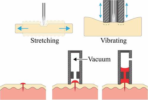 Figure 4. a – (left) Lateral stretching of skin resulting in reduced tissue deformation when lancing. (right) Vibration of skin introduced by a stimulator ring. b – Schematic of the application of suction to the lancing site in order to increase the volume of blood drawn.