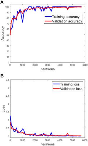 Figure 3 Training accuracy, validation accuracy, and cross entropy loss function plots during training phase of deep learning model. Training accuracy (performance in percentage) to correctly identify a trained image, validation accuracy (performance in percentage) to correctly identify a nontrained image (A) and cross entropy loss function (B) over 5710 iterations or training steps.