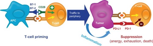 Figure 4 PD-L1 expressed on tumor cells endogenously or induced by association with T-cells. Tumor cells express PD-L1 and bind to PD-1 on T-lymphocytes, thus suppressing the ability of T-lymphocytes to recognize and destroy tumor cells. This mechanism of evading the innate immune system is exploited by various types of tumor cells.Abbreviation: APC, antigen-presenting cells.