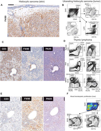 Figure 3. Immuno phenotypical features of maligancies in p53+/- irradiation model. (A) F4/80 immunohistochemistry of subcutaneous tumor. (#135A) (B) FACS analysis of large ulcerating tumor. (#87A) (C) Immunohistochemistry of liver in lymphoma with the indicated antibodies. (#124A). (D) FACS analysis of thymus, liver, and spleen in mouse with thymic lymphoma. (#78A) (E) Immunohistochemistry of liver of mouse with severe mixed hematopoietic proliferation. (#44C). (F) FACS Liver (#114A).