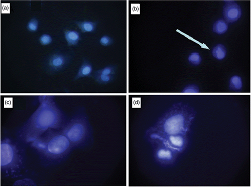 Figure 10. (Colour online) (a) 40× image of the A549 cells treated with GNP/PEI (b) 100× image of the A549 cells treated with GNP/PEI, (c) 40× image of the A549 cells treated with GNP/citrate and (d) 100× image of the A549 cells treated with GNP/Citrate.