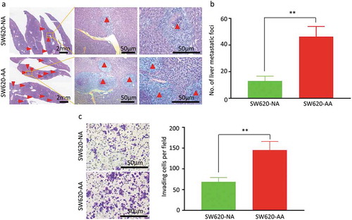 Figure 2. Increased invasion and liver metastasis of acid-adapted SW620 cells (a) Representative images showing the liver metastatic foci from SW620-NA and SW620-AA group. (b) Analysis of the number of metastatic foci by student,s t-test. (c) Representative image showing the invaded cells. (d) Analysis of the number of cells per fied by student,s t-test. *, <0.05;**,<0.01