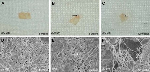 Figure 8 The morphology of the ICA-loaded PCL–gelatin membrane (A–C), and SEM micrographs of membrane surfaces (D–F) at different observation times after implantation.Note: The black arrows indicate the absorbed margin, and the white arrows indicate the pores.Abbreviations: ICA, icariin; PCL, polycaprolactone; SEM, scanning electron microscopy.
