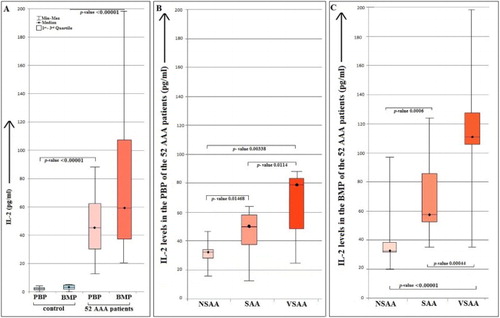 Figure 1. Showing the IL-2 levels in 52 AAA patients and in 10 control cases (A). A significant increase in the IL-2 level is observed in BMP than in PBP of the AAA patients. The levels of the IL-2 in the BMP and PBP of healthy controls were very low and almost similar. The observations are indicating higher level of IL-2 is associated in AAA in both the PBP and BMP. But as the immune reaction is occurring in the BM compartment, the IL-2 is even higher in BMP. The levels of IL-2 in the PBP (B) were lower than the BMP (C) of 52 AAA patients. The AAA patients were categorized in three groups NSAA, SAA and VSAA. The order of the level of IL-2 was VSAA>SAA>NSAA. In every group the level of IL-2 was higher in BMP than the corresponding PBP. The bracket lines are indicating the two groups, between which the Mann–Whitney U test was done. The p-values between every group were found to be <0.05. BMP: bone marrow plasma; PBP: peripheral blood plasma; AAA: acquired aplastic anaemia; NSAA: non-severe aplastic anaemia; SAA: severe aplastic anaemia; VSAA: very severe aplastic anaemia; BM: bone marrow