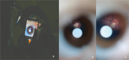 Figure 3. Trainings of ophthalmoscopy using smartphone ophthalmoscopes.