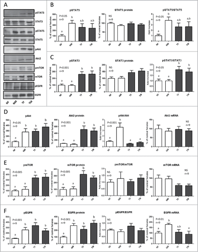 Figure 3. Expression and phosphorylation of STAT5, STAT3, Akt, mTOR and EGFR in the liver of GH-overexpressing transgenic mice and normal controls. Liver extracts from young adult normal female (NF), normal male (NM), GH-transgenic female (TF) and GH-transgenic male (TM) mice were analyzed by immunoblotting to determine the phosphorylation and protein content, or by reverse-transcriptase quantitative PCR (qRT-PCR) to assess mRNA levels. (A) Representative results of immunoblots are shown. (B) sTAT5 phosphorylation at Tyr694/696 (pSTAT5), protein content and phos-phorylation/protein content ratio. STAT5 was also used as a control for equal loading. (C) STAT3 phosphorylation at Tyr705 (pSTAT3), protein content and phosphorylation/protein content ratio. (D) Akt phosphorylation at ser473 (pAkt), Akt2 protein content, phosphorylation/protein content ratio and mRNA levels. (E) mTOR phosphorylation at ser2448 (pmTOR), protein content, phosphorylation/protein content ratio and mRNA levels. (F) EGFR phosphorylation at Tyr845 (pEGFR), protein content, phosphorylation/protein content ratio and mRNA levels. Results are expressed as % of the mean values in normal female mice. Data are the mean ±SEM of 9 sets of different individuals per group (n). Different letters denote significant difference at p < 0.05. NS, not significant.