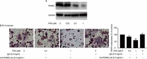 Figure 5. PAH inhibits RANKL expression and inhibition of RANKL suppresses PC-3 cells-induced osteoclastogenesis. (a) Protein lysates of PC-3 cells pretreated with PAH (0, 0.25, 0.5, 1 μM) were subjected to western blot analysis with RANKL antibody. (b) PC-3 cells were pretreated with PAH (0, 0.5, 1 μM) for 24 h, incubated with anti-RANKL antibody (0.5 mg/ml) or mouse IgG (0.5 mg/ml), then the conditioned medium was collected. RAW 264.7 cells were incubated with the above conditioned medium of PC-3 cells for 7 days, and finally subjected to TRAP staining. The percentages of TRAP positive osteoclasts were quantified in three randomly selected x100 fields. * p < 0.05, ** p < 0.01 vs. control. Abrreviations: PAH, perillaldehyde; TRAP, tartrate resistant acid phosphatase; RANKL, receptor activator of nuclear factor-κB ligand.