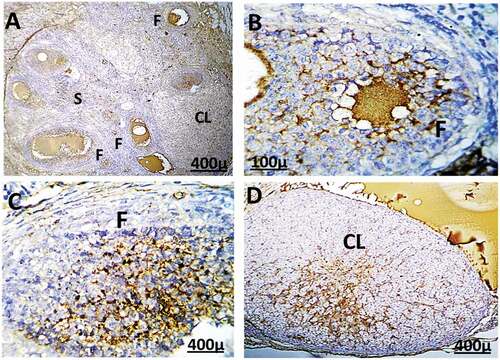 Figure 10. Immunohistochemistry showing caspase-3 streptavidin-biotin- peroxidase staining method in ovarian tissue of adult female rats treated with (2 mg/kg of AgNps) low dose. Showing positive and moderate expression of immune stain caspase-3.