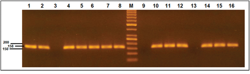 Figure 3. Agarose gel electrophoresis results of T315I mutation. Lane M is 50 bp DNA marker. Lanes 1, 5,7,11 and 15 are positive T315I mutation. Lanes 3, 9 and 13 are negative T315I mutation cases. Lanes 2,4,6,8,10,12,14 and 16 represent the wild type of all cases.