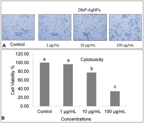 Figure 6 (A) Cytotoxicity effect: Result image of Control, DtbP-AgNPs (Dead cell %), against HepG2 cancer cells. (B) Cytotoxicity (Cell viability %) result of DtbP-AgNPs. Columns with different letters (a,b,c) are statistically signiﬁcant at P < 0.05.