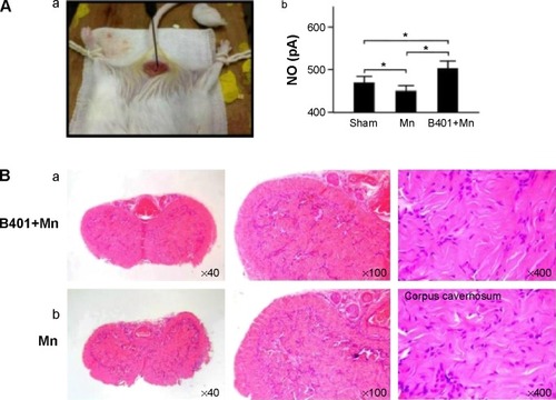 Figure 2 Cavernosal nitric oxide (NO) levels and H&E staining in Mn-treated mice with and without oral B401 treatment.