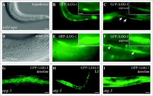 Figure 5. GFP::LGG-1 pattern at post-embryonic stages. (A and B) GFP::LGG-1 is diffusely localized in the hypodermis of wild-type animals. (A) DIC image of the animal shown in (B). (C) GFP::LGG-1 forms numerous small punctate structures in the hypodermis after the animals are starved for 4 h. (D and E) GFP::LGG-1 is diffusely localized in seam cells of wild-type animals. (D) DIC image of the animal shown in (E). (F) GFP::LGG-1 forms many small punctate structures in the seam cells after the animals are starved for 4 h. Inserts show magnified views. (G) Numerous GFP::LGG-1 punctate structures are observed in the intestine of epg-5 mutants. L4 larvae are shown in (A-G). (H and I) A large number of GFP::LGG-1 puncta accumulate in atg-3 mutants at the L1 larval stage (H), but largely disappear at late larval stage (I). Scale bars: 20 μm (A–C, G-I); 10 μm (D–F); 10 μm (inserts in (B and C); 5 μm (inserts in (E and F).