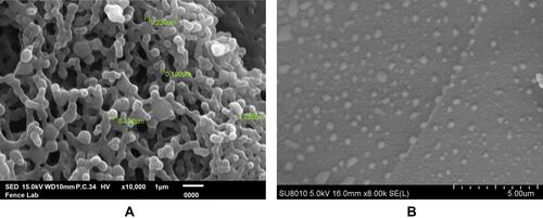 Figure 1 The morphology and size of NPs. Morphology of nanoparticles was observed by a scanning electron microscope at 10,000× magnification.