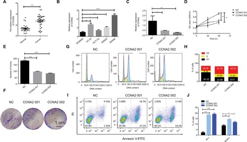 Figure 5 CCNA2 knockdown suppressed colon cancer cell proliferation by impairing cell cycle progression and inducing apoptosis.Notes: (A) Expression level of CCNA2 gene in 33 paired CRC tissues (n=3; ***P<0.001; two-tailed t-test). (B) Expression level of CCNA2 gene in colon normal cell line NCM460 and CRC cell lines HT-29, HCT116, SW620, and SW480 (n=3; *P<0.05, **P<0.01, ***P<0.001, ****P<0.0001; two-tailed t-test). (C) Expression level of CCNA2 were examined after siRNA transfection in SW480 cells (n=3; *P<0.05, **P<0.01; two-tailed t-test). (D) The cell proliferation rates were analyzed by CCK-8 assay. All values were mean±SD (n=3; **P<0.01; two-tailed t-test). € Graph illustrating quantified values (n=3; ****P<0.0001; two-tailed t-test). (F) Colony formation assays were performed. (G, H) Distribution of cells in three cell cycle phases was examined by flow cytometry assay, and the graph shows quantification for each phase. (I) For measurement of apoptotic cells, cells were stained with both AV and PI, and analyzed by an image flow assay. (J) Graph illustrating the quantification of apoptotic cells, AV+ means early apoptosis, AV/PI+ means late apoptosis (n=3; *P<0.05, **P<0.01, ***P<0.001; two-tailed t-test).Abbreviations: AV, Annexin V FITC; CRC, colorectal cancer; CCK-8, cell counting kit-8, PI, propidium iodide; NC, negative control.