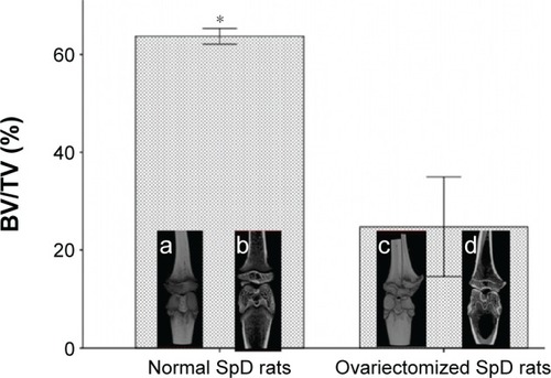 Figure 7 m-CT analysis of normal and ovariectomized rats before implantation.Notes: BV/TV for the tibia compartment in the knee joint was used to identify relative changes in BV density. Data are expressed as mean ± standard error of the mean (n=3), *P<0.05 indicates significance vs PT: a, complete 3D image in the knee joint of a normal rat; b, coronal 3D screenshot in the knee joint of an ovariectomized rat; c, complete 3D image in the knee joint of an ovariectomized rat; d, coronal 3D screenshot in the knee joint of an ovariectomized rat.Abbreviations: 3D, three-dimensional; BV, bone volume; m-CT, microcomputed tomography; PT, polished Ti; SpD, Sprague Dawley; Ti, titanium; TV, total volume.