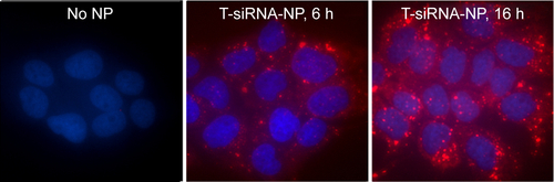 Figure S1 Cellular uptake of T-siRNA-NP to HER2+ BT474 cells.Notes: BT474 were seeded in a 96-well plate at a density of 10,000 cells per well. The next day, cells were transfected with T-NP loaded with 2 wt.% of nontargeting scrambled siRNA tagged with DY677 at a concentration of 60 nM siRNA. One hour after transfection, cells were washed with D-PBS and incubated for 6 and 16 h for further intracellular transport of the siRNA. Images were taken on an EVOS FL Auto fluorescence microscope (Life Technologies) at a magnification of 400×.Abbreviation: PBS, phosphate-buffered saline.