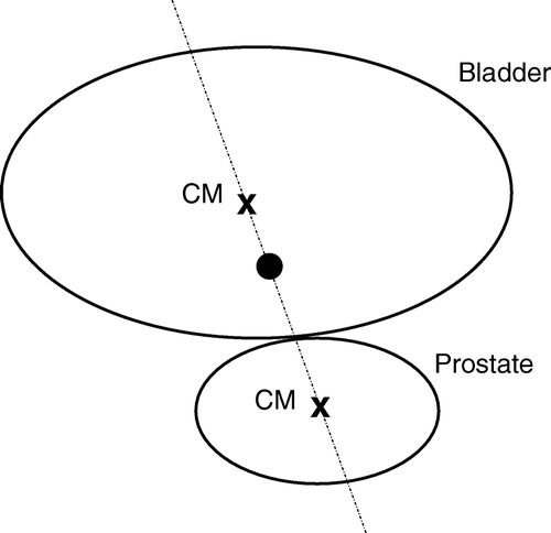Figure 1.  Definition of the reference point. The top and bottom ellipses represents the bladder and the prostate respectively. The axis goes through the centres of mass (CM), marked with x, of the two organs. The reference point, marked with a black circle, is located half-way between the bladder CM and the edge between the bladder and prostate.