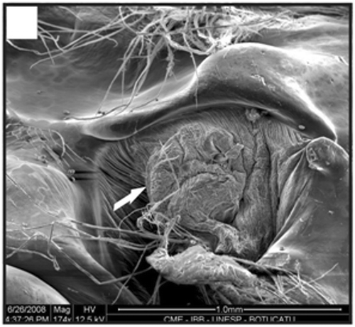 Figure 20. Gonopore of a male with 12.4 mm CL. Gonopore opening (arrow). Scale bar = 1 mm.