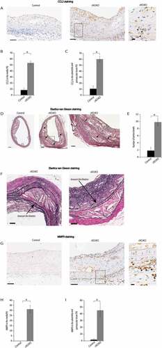 Figure 8. Atg7cKO:apoeKO mice under Western diet showed increased number of lamina breaks. (A) Representative histological sections of abdominal aorta stained with CCL2 from control Atg7f/f:apoeKO mice (Control) and Atg7cKO:apoeKO mice (cKO:KO) fed a Western diet. Scale bars: 50 μm. An enlarged view of the boxed area is shown on the right. arrowheads indicate CCL2-positive cells. Scale bars: 10 μm.　(B) The percentage of CCL2-positive cells in the media were evaluated. Data are mean ± SEM of 4 Control and 7 cKO:KO each. *P < 0.001 vs Control. (C) The percentage of CCL2-positive cells in the adventitia and perivascular tissue were evaluated. Data are mean ± SEM of 4 Control and 7 cKO:KO each. *P < 0.001 vs Control. (D) Representative histological sections of abdominal aorta from Control and cKO:KO stained with Elastica van Gieson. Scale bars: 100 μm. Enlarged view of the boxed area is shown on the right.　Arrows indicate the area of lamina breaks. Scale bars: 50 μm. (E) The number of lamina breaks was evaluated. Data are mean ± SEM of 11 Control and 21 cKO:KO each. *P < 0.05 vs Control. (F) Representative of abdominal aorta stained with Elastica van Gieson staining from Control and cKO:KO. Scale bars: 50 μm.（G）Representative histological sections of abdominal aorta stained with MMP9 from Control and cKO:KO fed a Western diet. Scale bars: 50 μm. An enlarged view of the boxed area is shown on the right. arrowheads indicate MMP9-positive cells. Scale bars: 10 μm. (H) The percentage of MMP9-positive cells in the media were evaluated. Data are mean ± SEM of 4 Control and 5 cKO:KO each. *P < 0.01 vs Control. (I) The percentages of MMP9-positive cells in the adventitia and perivascular tissue were evaluated. Data are mean ± SEM of 4 Control and 5 cKO:KO each. *P < 0.05 vs Control.