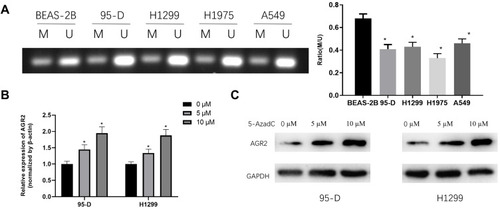 Figure 2 The methylated state of AGR2 in LUAD cells. (A) MSP results of AGR2 in both LUAD cell lines and normal cell line. U refers to the unmethylated alleles, M refers to the methylated alleles); (B) qRT-PCR was used to detect the mRNA expression level of AGR2 after 95-D and H1299 cells were treated with different doses of DNA methyltransferase inhibitor 5-AzadC; (C) Western blotting assessed protein expression of AGR2 in 95-D and H1299 cells after treatment of different doses of DNA methyltransferase inhibitor 5-AzadC. *P<0.05.