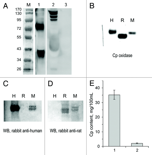 Figure 3. HCT116 cells produce human Cp in vitro and in tumor xenografts. (A) WB with antibodies to human Cp. Lane M, molecular weight marker (prestained proteins, Fermentas, code SM0671). Lane 1, culture medium in which HCT116 cells were grown; lane 2, human serum (positive control); lane 3, bovine serum (negative control). The two WB panes are sections of a single blot. (B) Oxidase activity in human (H), rat (R), and murine (M) sera, o-dianisidine stain of a non-denaturing 8% PAGE, 1 μl of serum per lane; WB of the same samples with antibodies to human (C) and rat (D) Cp, 0.5 μl of serum per lane. Immune complexes were detected using a goat anti-rabbit IgG-conjugated peroxidase/α-naphthol assay. (E) Human Cp content as measured by dot-spot hybridization with [125I]-mAB-hCp. One, human serum; 2, serum of HCT116-bearing nude mice (n = 6).