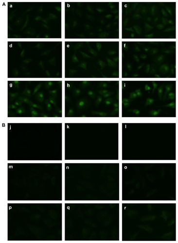 Figure 6 (A) Time study of cellular uptake of ellipticine from the EAK-EPT complex at (a) 5 seconds, (b) 45 seconds, (c) 1 minute, (d) 2.5 minutes, (e) 5 minutes, (f) 30 minutes, (g) 1 hour, (h) 1.5 hours, and (i) 2 hours. (B) Time study of cellular uptake of ellipticine from the EPT-H2O control at (j) 5 seconds, (k) 45 seconds, (l) 1 minute, (m) 2.5 minutes, (n) 5 minutes, (o) 30 minutes, (p) 1 hour, (q) 1.5 hours, and (r) 2 hours.Abbreviations: EAK, self-assembling EAK16-II peptide; EPT, ellipticine.