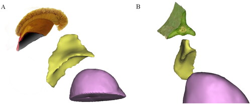 Figure 2. The 3D structure of adrenal glands. (A) The overall shape of the right adrenal gland with a deeper inferior sulcus looked like the ‘llama hat’ in a 32-year-old male patient. (B) The overall shape of the right adrenal gland was similar to the triangular leaf of a pitaya in a 62-year-old female patient.