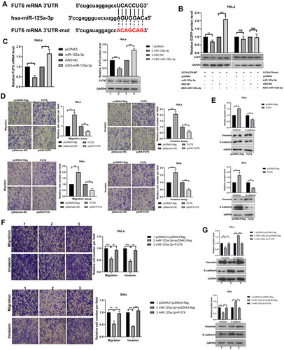 Figure 4 FUT6 is a direct target of miR-125a-3p and enhances the migration and invasion in cervical cancer cells. (A) The schematic showed potential miR-125a-3p binding sites and mutation sites in FUT6 3’UTR. (B) Western blotting detected the EGFP protein level in HeLa cells after co-transfection with the corresponding plasmid. (C) The mRNA and protein levels of endogenous FUT6 were detected when overexpression and knockdown miR-125a-3p. (D) The migration and invasion ability of CC cells was detected after transfection with overexpression plasmids (pcDNA3-flag/FUT6) and knockdown plasmids (pshR-FUT6) respectively. (E) Western blotting assessed the protein level of key molecular markers of EMT in CC cells when overexpression FUT6. (F) The migration and invasion ability of CC cells after co-transfection of FUT6 and miR-125a-3p. (G) Western blotting assessed the protein level of key molecular markers of EMT in CC cells after FUT6 transfection in the presence of miR-125a-3p. Experiments were performed 3 times, and data are presented as means ± SD. *P <0.05; **P <0.01; ***P <0.001.