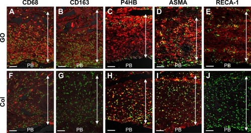 Figure 2 Immunohistochemical observation of GO scaffold.Notes: (A, F) CD68, (B, G) CD163, (C, H) P4HB, (D, I) ASMA, and (E, J) RECA-1, stained in red. Nuclei are stained green with TOTO-3. Double-headed arrows indicate the implanted scaffold. Scale bars represent 100 μm.Abbreviations: ASMA, α-smooth muscle actin; Col, collagen; GO, graphene oxide; P4HB, prolyl-4-hydroxylase beta; PB, preexisting bone; RECA-1, rat endothelial cell antigen-1.