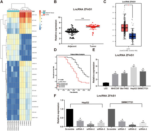 Figure 1 ZFAS1 is upregulated in HCC patients and associated with poor prognosis. (A) The normal tissues and tumor tissues were analyzed by Arraystar Human LncRNA microarray V2.0 (Agilent_033010 Probe Name version). Heatmap represents for 30 ectopic expressed lncRNAs. (B) The ZFAS1 expression between normal tissues and tumor tissues measured by RT-qPCR. (C) ZFAS1 expression in normal tissues (n = 160) and tumor tissues (n = 369) validated with TCGA database by GEPIA (http://gepia.cancer-pku.cn/index.html). (D) Kaplan–Meier survival analysis of HCC patients with high or low ZFAS1 expression. (E) The ZFAS1 expression between human normal hepatocytes L02 and HCC cell lines assessed by RT-qPCR. (F) siRNAs targeting ZFAS1 sequences were transfected into HepG2 and SMMC7721 cells while scramble siRNA served as negative control. The data are expressed as the mean ± SD. In panel (E and F), one-way ANOVA and Tukey’s multiple comparison test were used to determine statistical significance, while in panel A, paired t test was used. In panel C, E, and F, *p < 0.05 vs tumor tissues, L02 cells or Scramble treatment; In panel B, **p < 0.01 vs adjacent tissues.Abbreviations: HCC, hepatocellular carcinoma; TCGA, The Cancer Genome Atlas; GEPIA, gene expression profiling interactive analysis; lncRNA; long noncoding RNA; LIHC, liver hepatocellular carcinoma; ZFAS1, ZNFX1 antisense RNA 1; RT-qPCR, reverse transcription-quantitative polymerase chain reaction; siRNA, small interfering RNA; SD, standard deviation; ANOVA, analysis of variance.