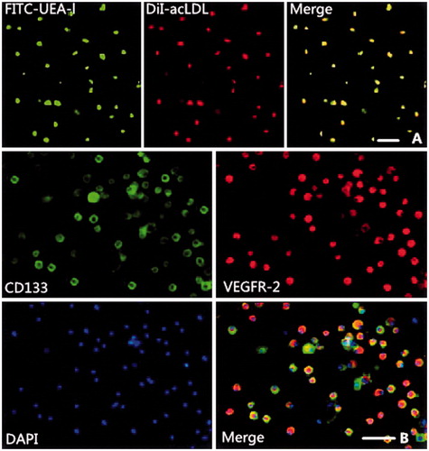 Figure 1. Characterization of bone marrow-derived endothelial progenitor cells (EPCs). (A) Green fluorescence (upper left) represents cells positive for fluorescein isothiocyanate-labeled Ulex europaeus agglutinin (FITC-UEA-l). Red fluorescence (upper middle) represents cells positive for 1,1′-dioctadecyl-3,3,3′,3′-tetramethylindocarbocyanine-labeled acetylated low-density lipoprotein (DiI-acLDL). Yellow fluorescence (upper right) represents differentiated endothelial progenitor cell-like adherent cells that were double-positive for uptake of DiI-acLDL and binding with FITC-UEA-l. (B) The cultured mononuclear cells (MNCs) were further characterized by immunofluorescent staining using the EPC-specific markers, CD133 (middle left) and vascular endothelial growth factor receptor 2 (VEGFR-2, middle right), and the nuclear marker 4,6-diamidino-2-phenylindole (DAPI, lower left). The cells further differentiated to cobblestone-like late EPCs. Bars in figure = 50 μm.