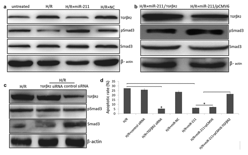 Figure 4. MiR-211 overexpression inhibited H/R induced NK-2 cell apoptosis through alleviating TGFβR2/TGF-β/SMAD signaling. (a) H/R induced NK-2 cells were transfected with miR-211 mimic or control NC and the protein levels were analyzed by Western blot assay. (b) H/R induced NK-2 cells were co-transfected with miR-211 mimic and pCMV6-TGFβR2 (TGFβR2) or pCMV6 and the protein levels were analyzed by Western blot assay. (c) H/R induced NK-2 cells were transfected with TGFβR2 siRNA or control siRNA and the protein levels were analyzed by Western blot assay. (d) Cell apoptosis was detected in H/R induced NK-2 cells transfected or co-transfected with TGFβR2 siRNA, pCMV6-TGFβR2, miR-211 mimic and their controls. Data shown are means ± SE for n = 3 independent experiments. Student’s t test, *P < 0.01