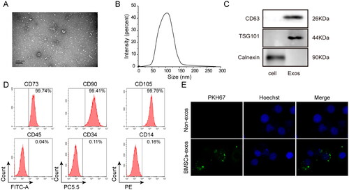 Figure 1. Isolation, identification, and internalization of exosomes derived from BMSCs. (A) Observation by transmission electron microscopy; (B) measurement of exosome size by nano-particle tracking molecule; (C) detection of BMSC-exos markers by western blot analysis; (D) detection of BMSC-exo markers by flow cytometry; (E) detection of labeled protein PKH67 by immunofluorescence assay. BMSC-exos: bone marrow MSC-derived exosomes. Three independent replications were performed.