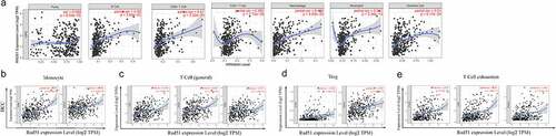 Figure 5. The relationship between Rad51 expression levels and immune filtrates in HCC. A. Rad51 expression level is significantly positive correlated with immune cells. Correlation analysis between Rad51 expression and immunological markers in HCC: B. Monocyte; C. T cell (general); D. Treg; E. T cell exhaustion