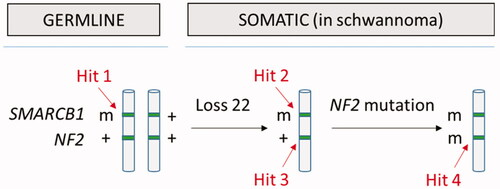 Figure 4. The four-hit, three-step model for tumorigenesis in schwannomatosis (here shown for SMARCB1): germline mutation in SMARCB1 (hit 1), loss of a region of chromosome 22 (hit 2 and 3) and pathogenic mutation in remaining WT NF2 allele (m = pathogenic mutation; + = WT). The same mechanism has also been demonstrated for germline LZTR1 mutations.