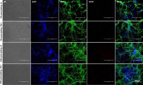 Figure 1. Murine cortical neurons in primary cultures are differentiated as neurons from progenitor cells. Phase contrast and fluorescent microscopic images showing primary cultures of cortical neurons from uninfected (UI) or ZIKV (I) infected (MOI 5; 72 h p.i.) groups at two different time points (72 and 120 h post plating). Cortical neurons were stained for neuronal marker (MAP-2) or astrocyte marker (GFAP) to show the presence of neurons and absence of glial cells. DAPI staining for nuclei serve as internal control. Uninfected neurons serve as control. Representative images obtained from EVOS FL system are shown. Scale bar indicates 200 μm in all panels.