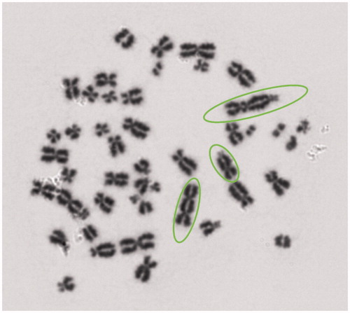 Figure 2. A cell from a control, 0 Gy, exposed sample identified by the DCScore software (automated scoring mode) as having three dicentrics; subsequently checked by eye and confirmed as containing 1 tricentric and 2 dicentrics (circled) – one of which was ignored according to the automated scoring protocol of laboratory DCA_4.